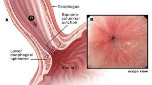 Normal endoscopy